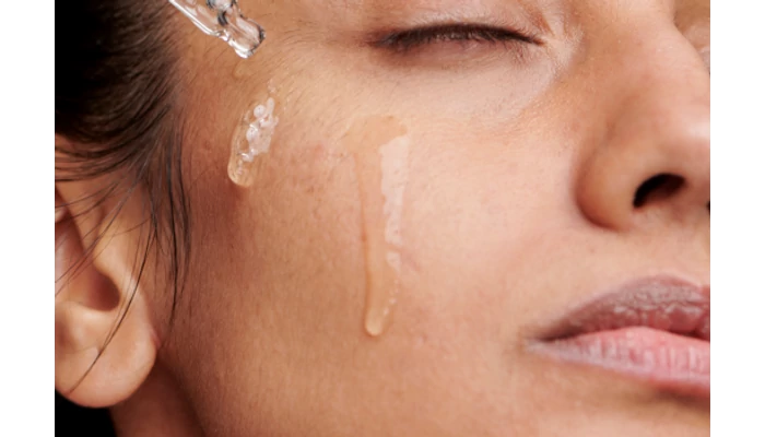 A niacinamide,  nemcsak pattanásos bőrre 