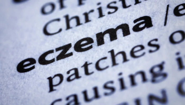Mire figyelj, ha ekcémás bőrtől szenvedsz