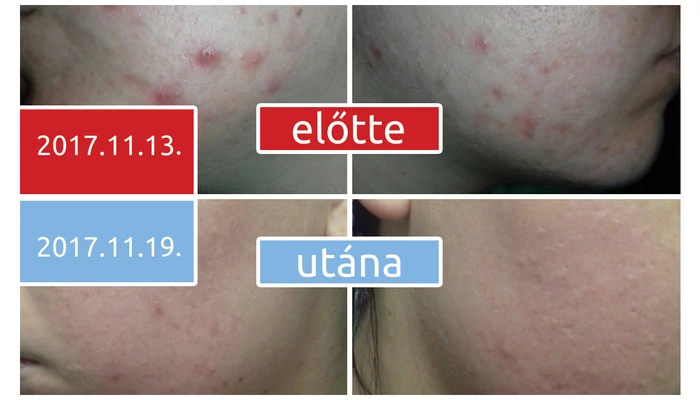 Hogyan szépülhet meg a bőröd egyik napról a másikra? Varázslat nélkül is megy!