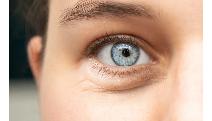 Hogyan tudod megszüntetni szem alatti pufikat, táskákat?